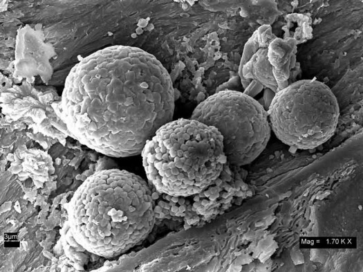 SEM micrograph of red objects (approx. 10 micron diameter) found in dinosaur bones. These are iron oxide framboid clusters. Source: Kaye, et al., PLoS ONE 3(7): e2808